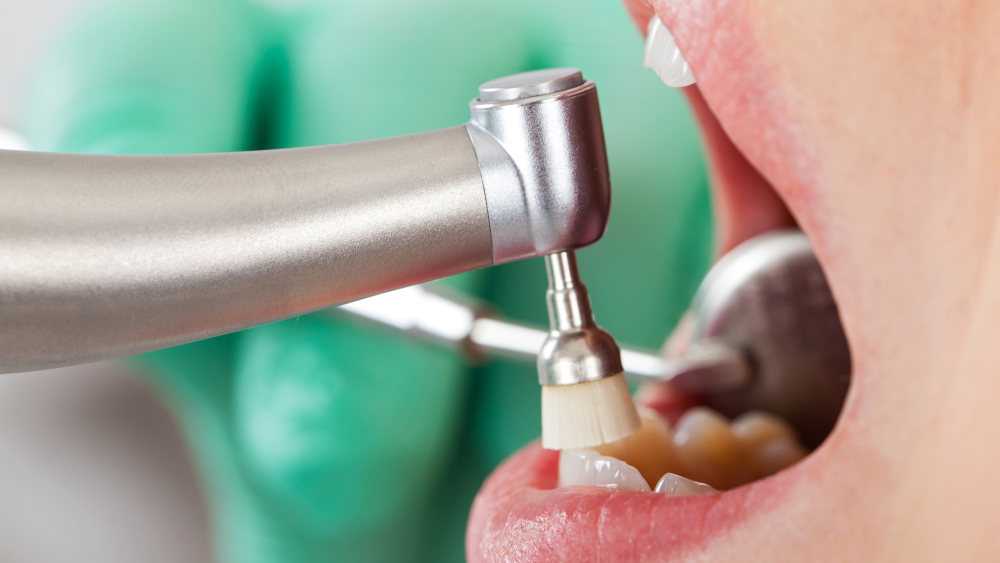 sredstva-dlya-ukrepleniya-desen-i-zubov-3.jpg sredstva-dlya-ukrepleniya-desen-i-zubov-3.jpg