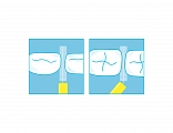 Межзубный ершик Plackers Interdental 0,45 мм